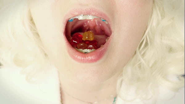 Asmr Mukbang: Eating In Braces! thumbnail