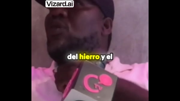 Complicaciones tras una cirug&iacute;a un testimonio impactante #elchicletv #negligencia #chiclenoticias #malapraxis #testimoni