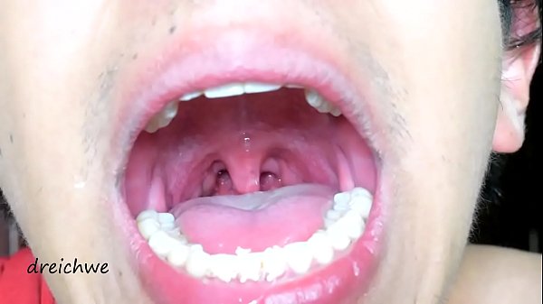 Deep Ovula In The Foreground thumbnail