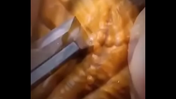 Video x&aacute_c minh