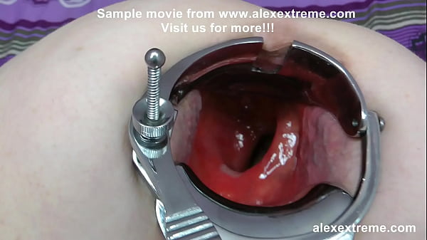 DGG both holes extreme opening with speculum 