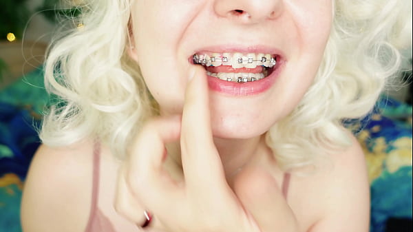 Cute Asmr Video Great Sound Of Eating With Braces 4k thumbnail
