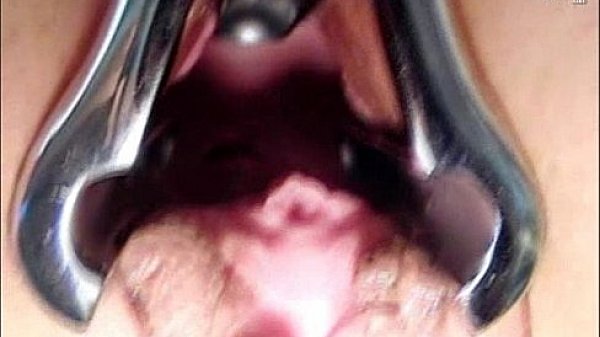 Rachael pussy gyno speculum fetish examined 