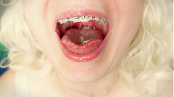 Asmr Video: Eating In Braces - Food Fetish thumbnail