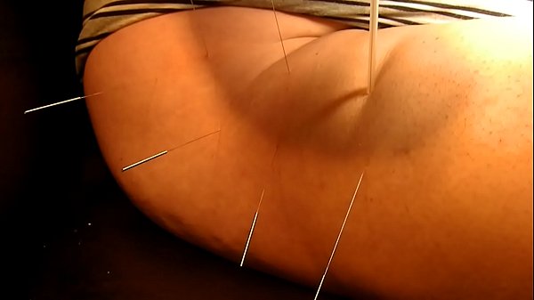 Play MP4 - Acupuncture 2 with Playerdoi