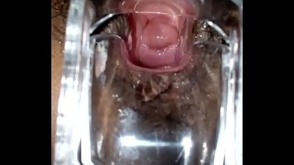 SLIM INDIAN BROWN_GIRL CERVIX SPECULUM CHECK VAGINAL OPENING