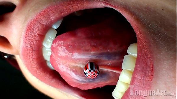 Pixie Opens Wide thumbnail