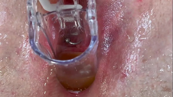 He Pee Into My Pussy By Speculum And I Squirt Too thumbnail
