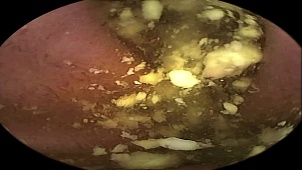 Into Giantess's Stomach(vore) thumbnail