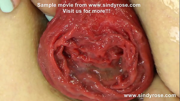 Fucking cock with pussy and anal prolapse Sindy Rose 