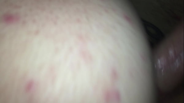 Nonton Dicknastytheillest Looks Like He Is On One Nothing But Skin Cock And Bones thumbnail