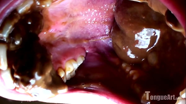 18 Year Old Pixie Shows Her Wide Open Mouth thumbnail