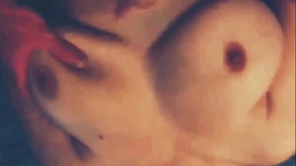 Pics of huge melons jugs 