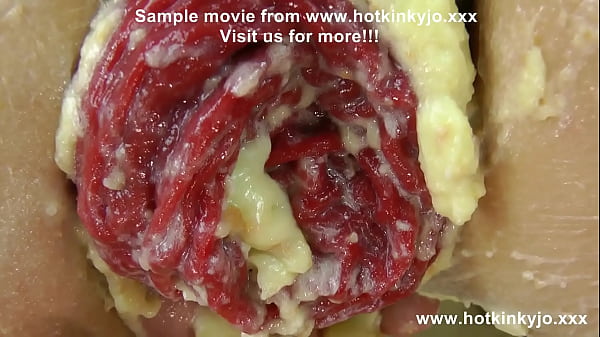 Play MP4 - Happy birthday Hotkinkyjo with cake fisting & anal prolapse