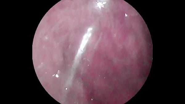 Play MP4 - Camera deep inside of the wet pussy and captured the intense female orgasm&excl;&excl;