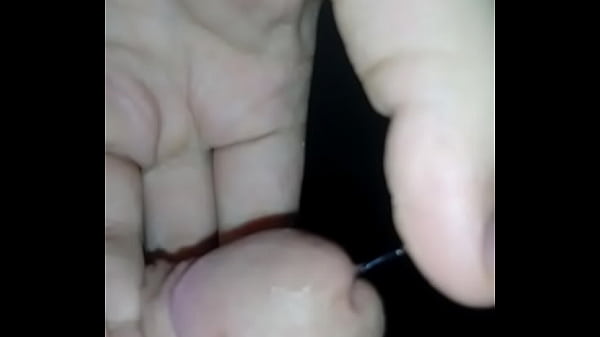 My dick after surgery 