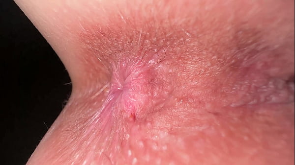 Play MP4 - A girl worries that her heavily pigmented anal looks dirty even when it's clean Is this true&quest;