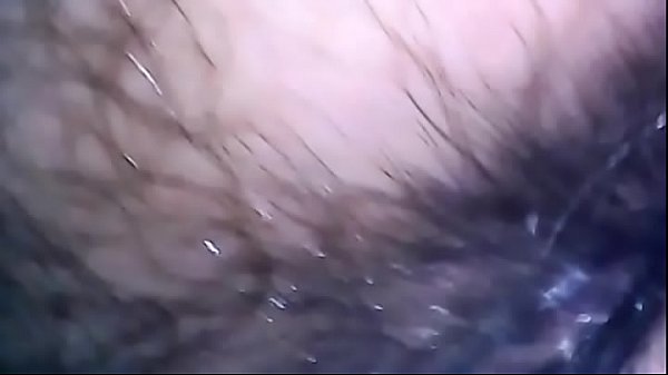 Play MP4 - Exciting endoscope exploration of mom's hairy pussy and her asshole