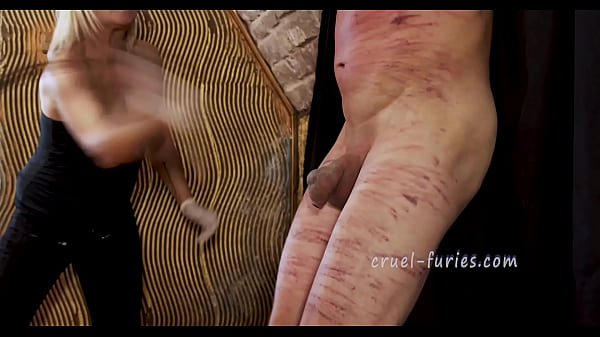 Play MP4 - Painful Red Bruises on Poor Guy's Flesh