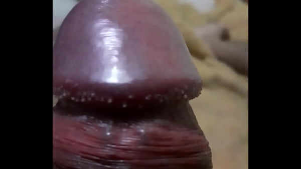 Play MP4 - Papulas perladas &sol; Pene enperlado natural