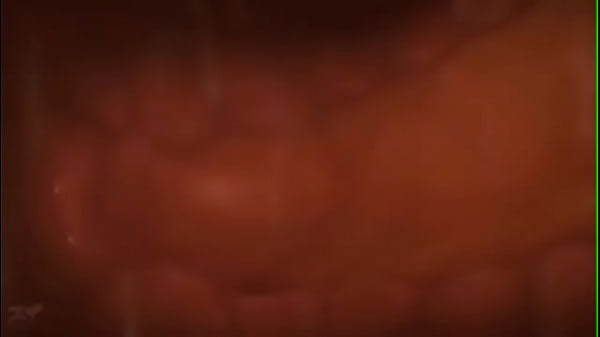 How pregnancy happens