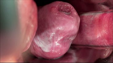 Masked Whore Extreme Cervix View And Double Vaginal Fisting thumbnail