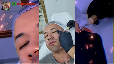 Motiva&ccedil;&atilde;o me transformei com a harmoniza&ccedil;&atilde;o facial veja o resultado