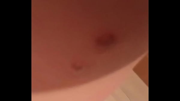 Sunt &icirc_mpușcat cu un airsoft in pulpa provoc&acirc_nd &icirc_mi o rana