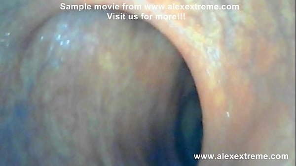 Play MP4 - Hotkinkyjo deep anal camera expedition&comma; XO speculum&comma; belly bulge & dildo