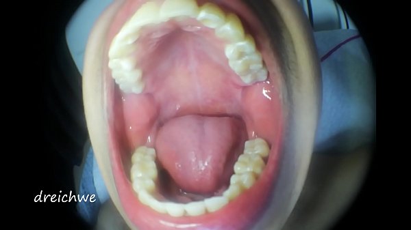 Mouth Fetish - Collection 25 thumbnail