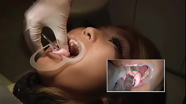 Japanese Girl At Dentist thumbnail