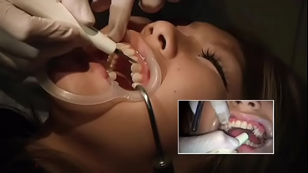 Nonton Japanese Girl At Dentist thumbnail