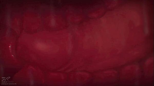 Play MP4 - All the way through