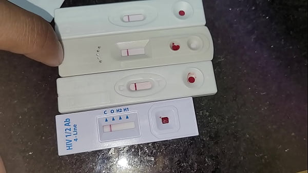 Fazendo Teste DST_em Casa_no Sabado Upas Fechadas