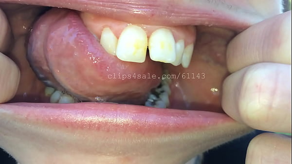 Play MP4 - Mouth &lpar;Annie&rpar; Video 2 Preview