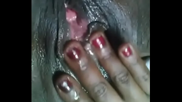 S 3885427627505000155 