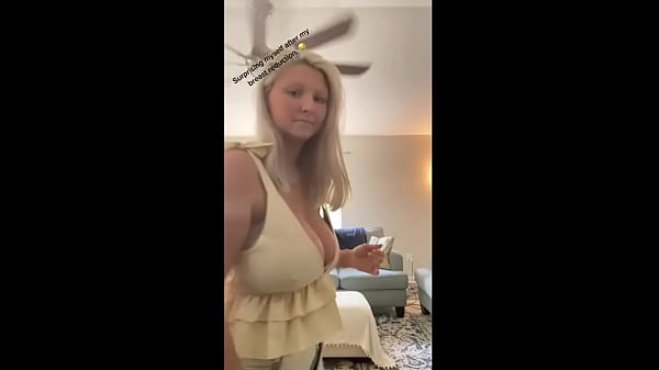 reduccion de senos parte 4