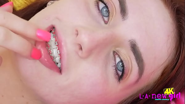 Beautiful 4K_video ofTeen with Braces