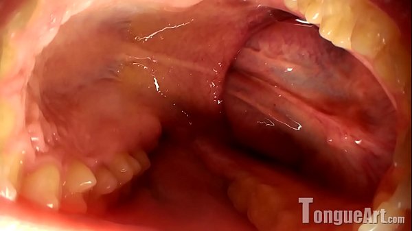 Pixie With Huge Tongue thumbnail