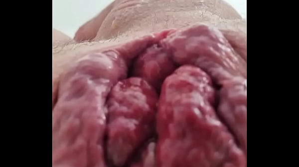 Juicy prolapse 1 