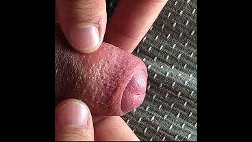 Foreskin Play (solo Bdsmman) thumbnail