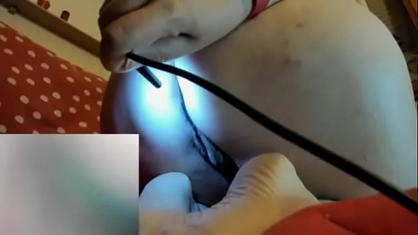 Fartsendoscopeassholehairy 20 4 