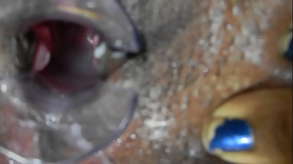 Black woman creampie   speculum look inside - trying get pregnant - inseminated 