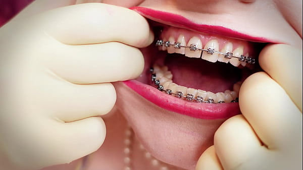 ASMR_video MILF wearing double layer_medical_gloves and showing braces 4k video fetish sounds