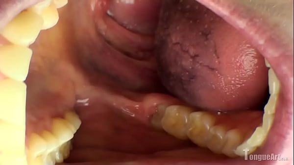 Model Shows Inside Of Mouth With Lollipop thumbnail