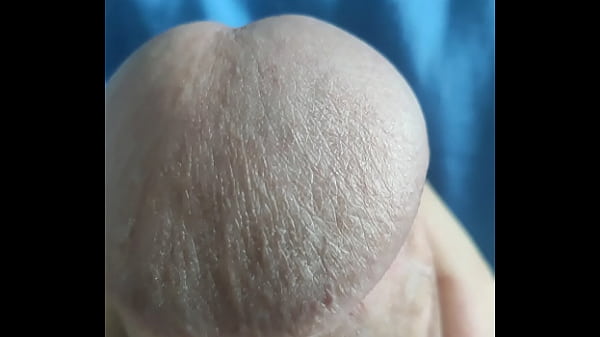 Pau grosso do cabe&ccedil_&atilde_o