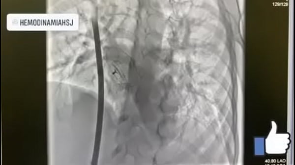 Nonton Aguascalientes M&eacute;xico thumbnail