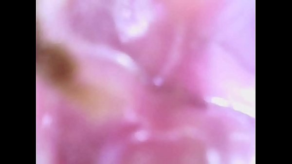 My ass inside with siime eye after enema