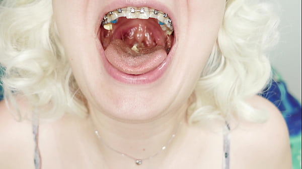 Food Fetish Asmr Video In Braces thumbnail