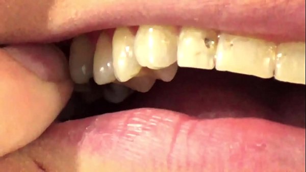 Teeth fetish chewing apart gummies vore